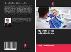 Copertina di Queratocitose odontogénica