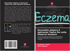 Copertina di Dermatite atópica E Aplicação Tópica De Leite Materno Humano