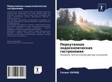 Bookcover of Перкутанная эндоскопическая гастрономия
