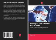 Обложка Cirurgias Periodontais Avançadas