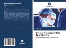 Copertina di Erweiterte parodontale Operationen