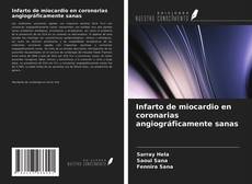 Buchcover von Infarto de miocardio en coronarias angiográficamente sanas