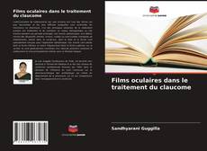 Bookcover of Films oculaires dans le traitement du claucome