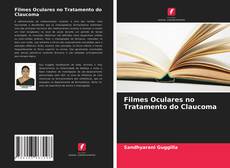 Filmes Oculares no Tratamento do Claucoma kitap kapağı