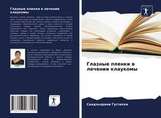 Bookcover of Глазные пленки в лечении клаукомы