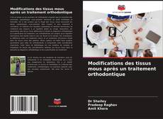 Bookcover of Modifications des tissus mous après un traitement orthodontique