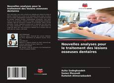 Copertina di Nouvelles analyses pour le traitement des lésions osseuses dentaires