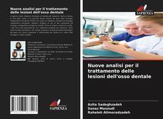 Bookcover of Nuove analisi per il trattamento delle lesioni dell'osso dentale