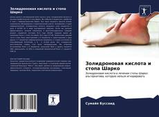 Золидроновая кислота и стопа Шарко的封面