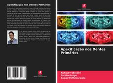 Couverture de Apexificação nos Dentes Primários