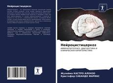 Bookcover of Нейроцистицеркоз
