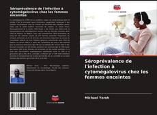 Couverture de Séroprévalence de l'infection à cytomégalovirus chez les femmes enceintes