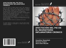 Bookcover of AFECTACIÓN DEL PIE EN EL REUMATISMO INFLAMATORIO CRÓNICO