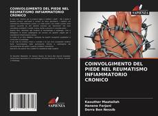 Copertina di COINVOLGIMENTO DEL PIEDE NEL REUMATISMO INFIAMMATORIO CRONICO