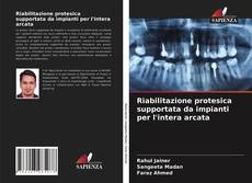 Riabilitazione protesica supportata da impianti per l'intera arcata的封面