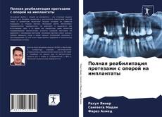 Полная реабилитация протезами с опорой на имплантаты的封面