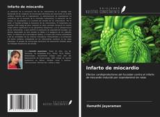 Bookcover of Infarto de miocardio