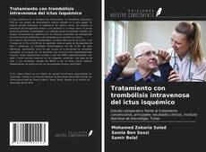 Capa do livro de Tratamiento con trombólisis intravenosa del ictus isquémico 