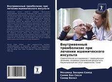 Portada del libro de Внутривенный тромболизис при лечении ишемического инсульта