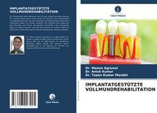 Copertina di IMPLANTATGESTÜTZTE VOLLMUNDREHABILITATION