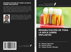 Bookcover of REHABILITACIÓN DE TODA LA BOCA SOBRE IMPLANTES