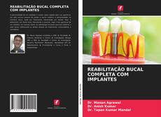Bookcover of REABILITAÇÃO BUCAL COMPLETA COM IMPLANTES