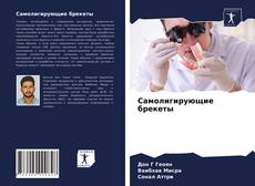 Bookcover of Самолигирующие брекеты