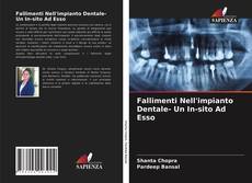 Fallimenti Nell'impianto Dentale- Un In-sito Ad Esso的封面