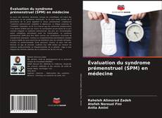 Couverture de Évaluation du syndrome prémenstruel (SPM) en médecine