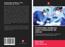 Buchcover von Crioterapia moderna como tratamento de câncer