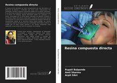 Bookcover of Resina compuesta directa