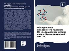 Обнаружение малярийного паразита На изображениях мазков крови: Биомедицинский подход kitap kapağı