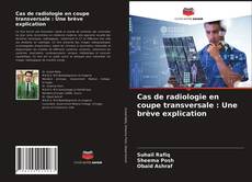 Cas de radiologie en coupe transversale : Une brève explication的封面