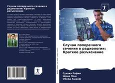 Случаи поперечного сечения в радиологии: Краткое разъяснение kitap kapağı