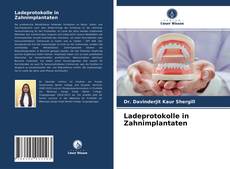 Ladeprotokolle in Zahnimplantaten kitap kapağı