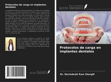 Portada del libro de Protocolos de carga en implantes dentales
