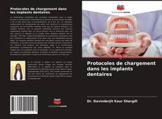 Couverture de Protocoles de chargement dans les implants dentaires