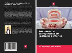 Copertina di Protocolos de carregamento em implantes dentários