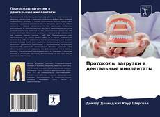 Протоколы загрузки в дентальные имплантаты kitap kapağı