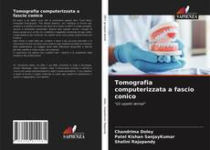 Tomografia computerizzata a fascio conico的封面