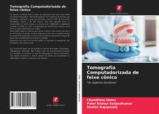 Bookcover of Tomografia Computadorizada de feixe cônico