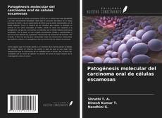 Bookcover of Patogénesis molecular del carcinoma oral de células escamosas