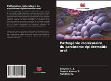 Couverture de Pathogénie moléculaire du carcinome épidermoïde oral