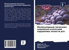 Couverture de Молекулярный патогенез сквамозно-клеточной карциномы полости рта
