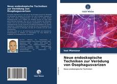 Bookcover of Neue endoskopische Techniken zur Verödung von Ösophagusvarizen