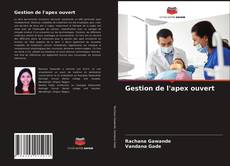 Couverture de Gestion de l'apex ouvert