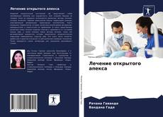 Borítókép a  Лечение открытого апекса - hoz