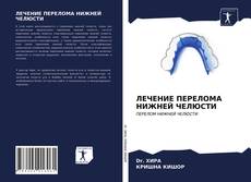 Borítókép a  ЛЕЧЕНИЕ ПЕРЕЛОМА НИЖНЕЙ ЧЕЛЮСТИ - hoz