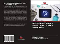 Couverture de GESTION DES TISSUS MOUS DANS LA PÉRI-IMPLANTITE