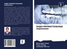 Copertina di ЭНДО-ПЕРИОСТАЛЬНЫЕ поражения